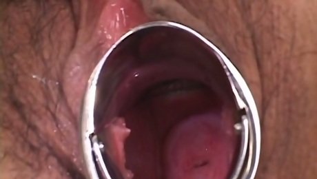 Fuckable Japanese hoe Misato Kuninaka gets her vagina widened with gynecological speculum